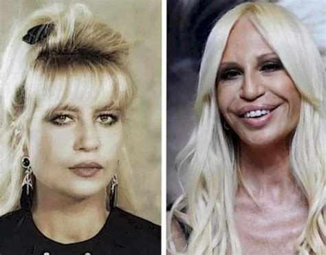 donatello versace|donatella versace face what happened.